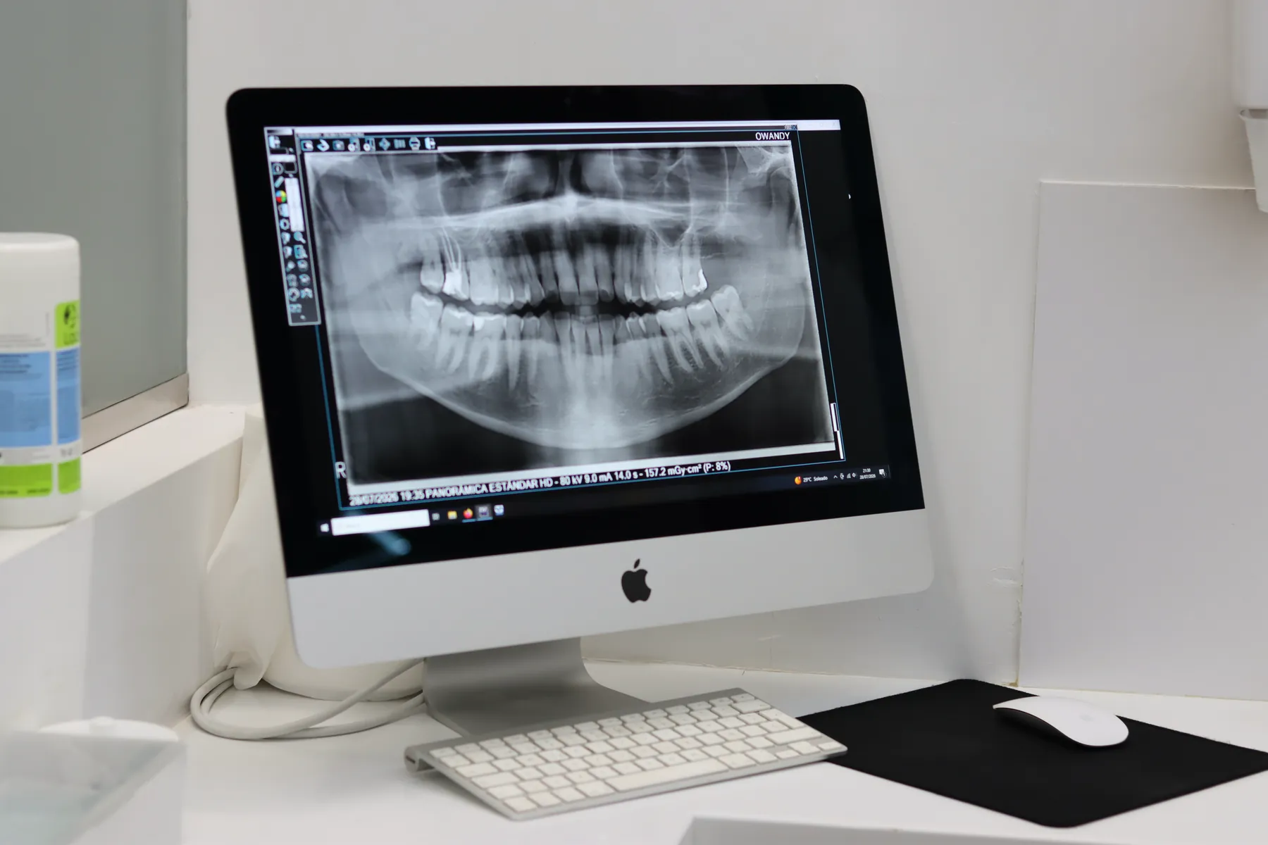 Ortopantomografía revisada en pantalla en Valencia Dental