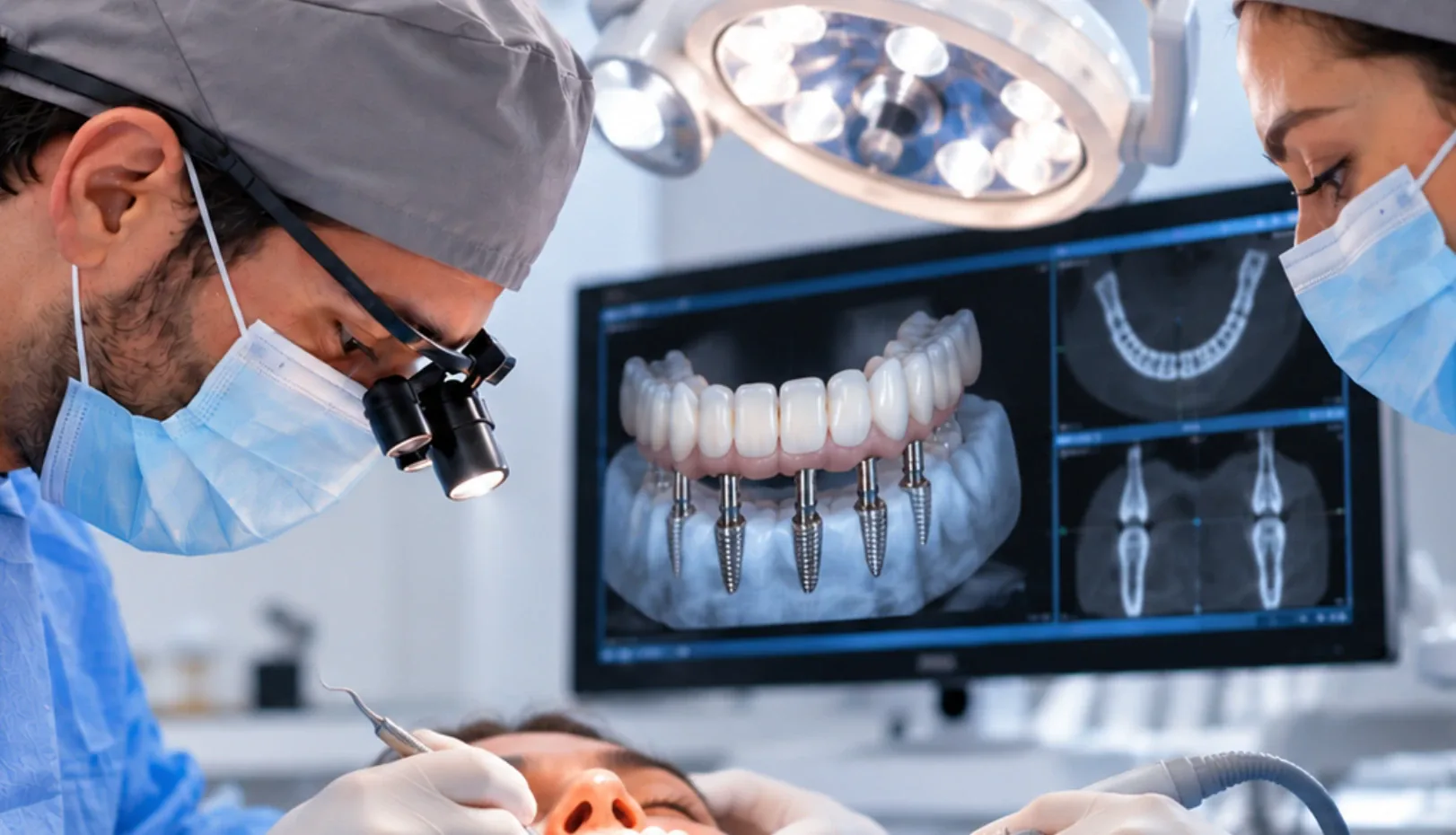 Colocación de implantes de carga inmediata con la arcada completa planificada en pantalla